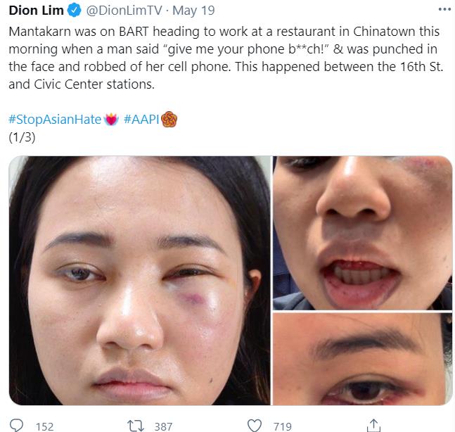 亚裔女搭地铁时突遭暴力 脸被嫌犯打肿